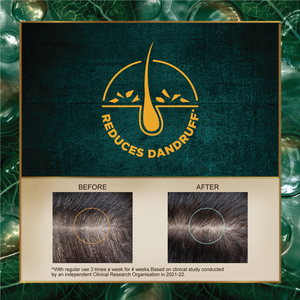 Indulekha Dandruff Treatment Shampoo - 580ml